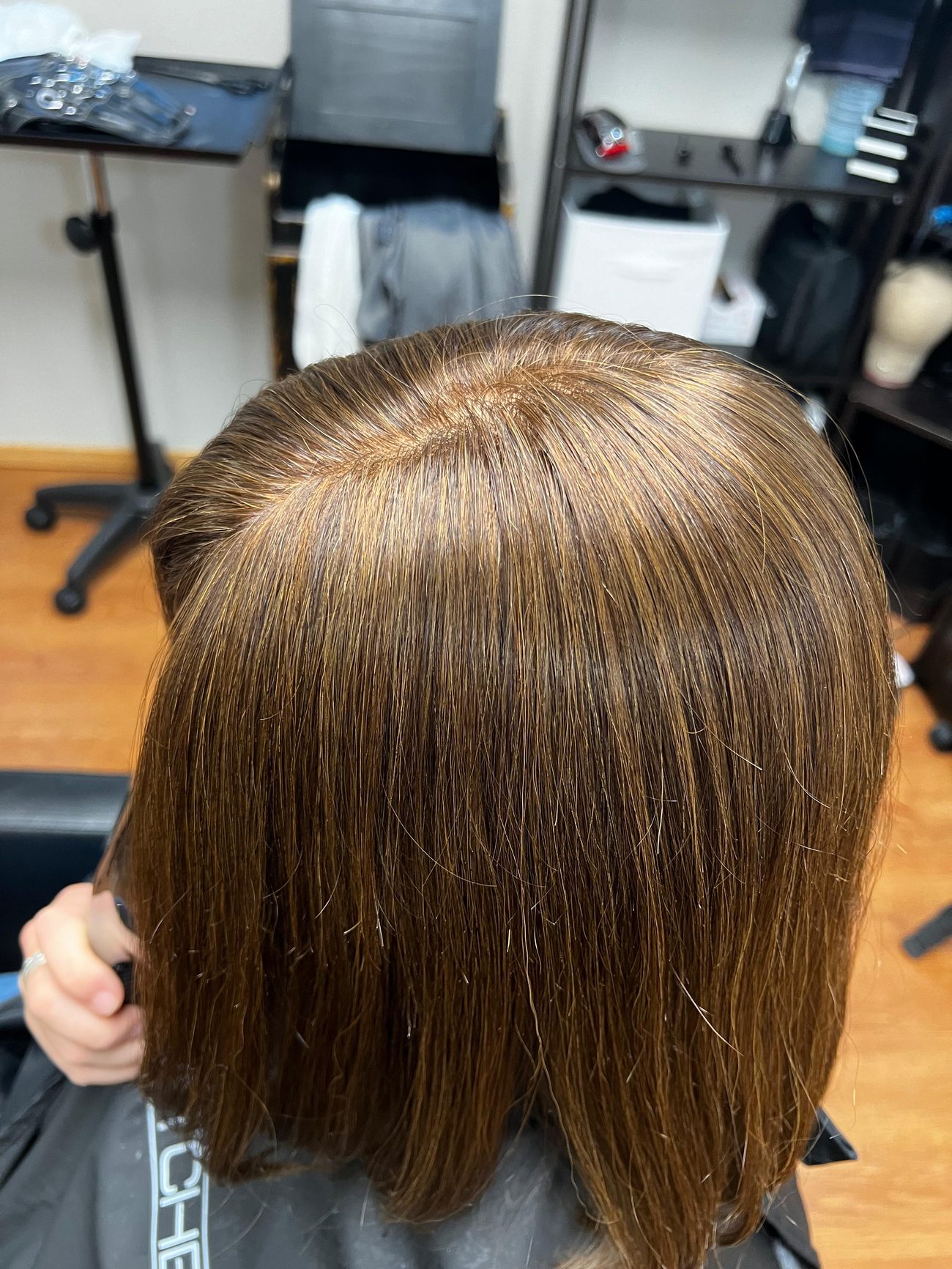 The same crown after a custom topper was fitted and blended